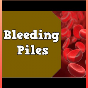 Bleeding piles