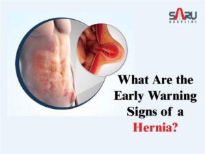 What Are the Early Warning Signs of a Hernia?