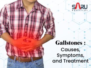 Gallstones: Causes, Symptoms, and Treatment