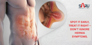 Early Hernia Symptoms You Should Never Ignore